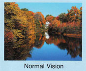 Normal Vision